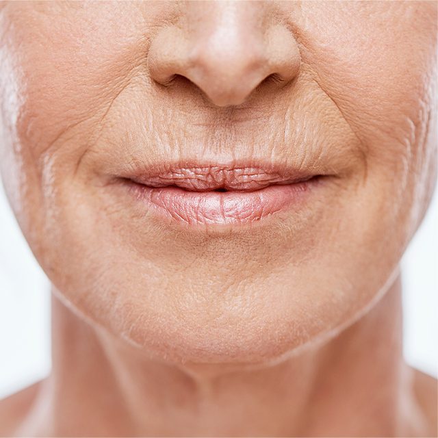 woman with fine lines and wrinkles around her mouth